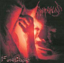 Acephalus (USA) : Fetal Display